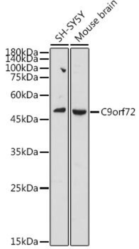 Anti-C9orf72 Antibody, 100 µl