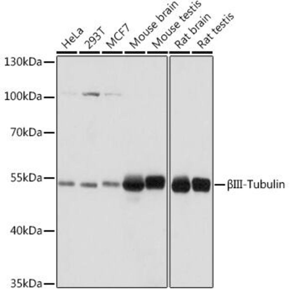 Anti-beta III Tubulin Antibody, 100 µl