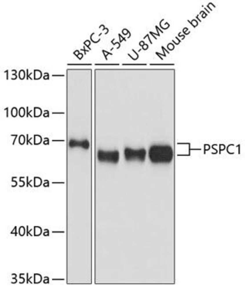 Anti-PSPC1 Antibody, 100 µl
