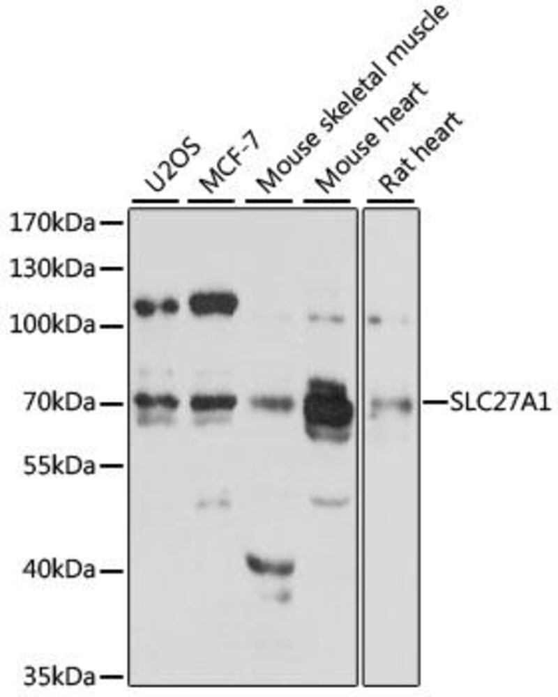Anti-FATP1 Antibody