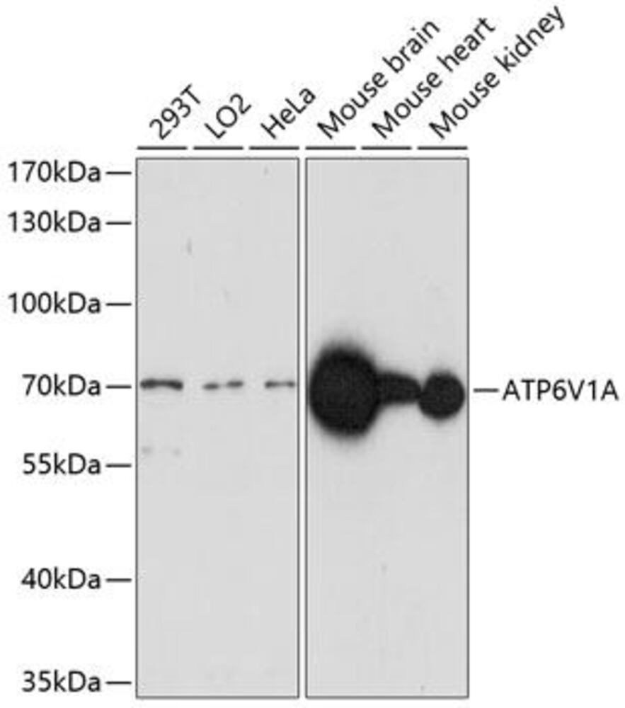 Anti-ATP6V1A Antibody, 100 µl