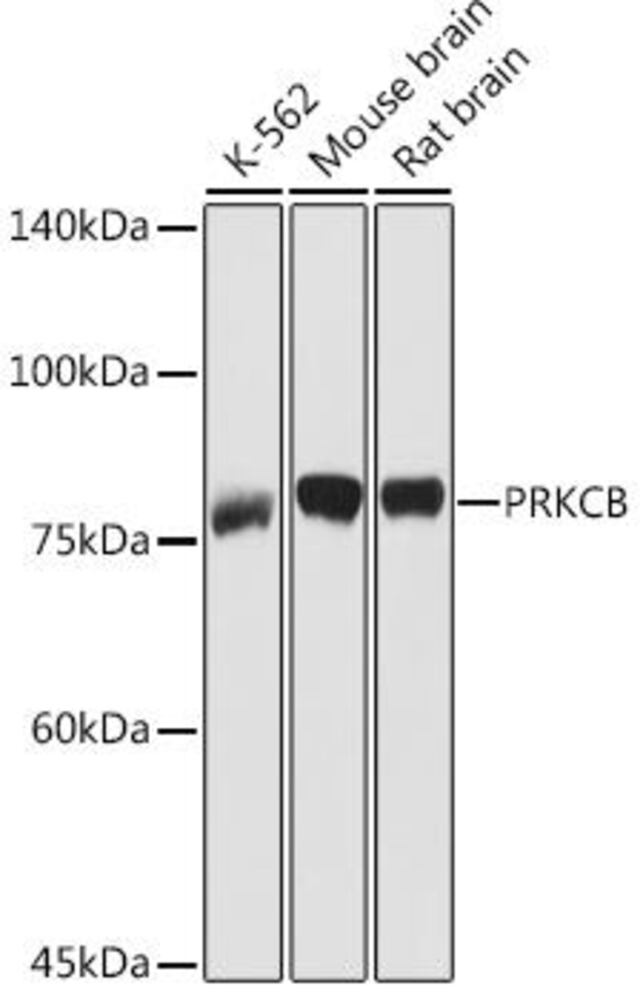 Anti-PKC beta Antibody, 100 µl