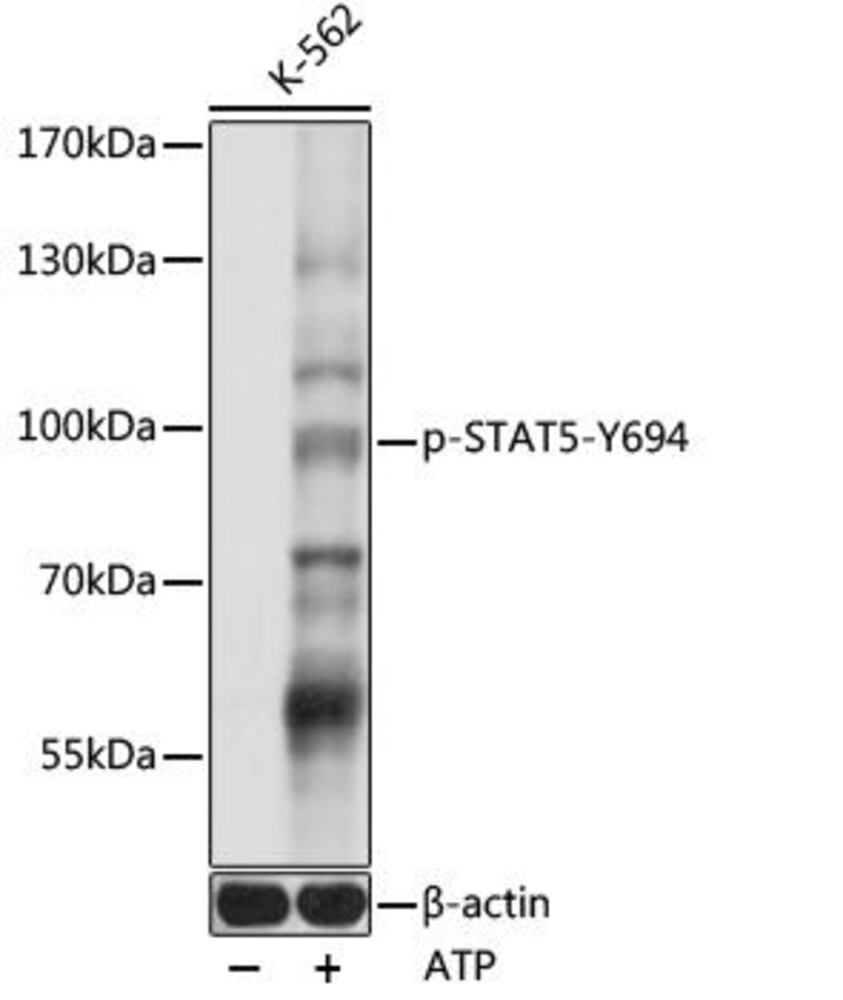 Anti-STAT5 (phospho Tyr694) Antibody, 100 µl