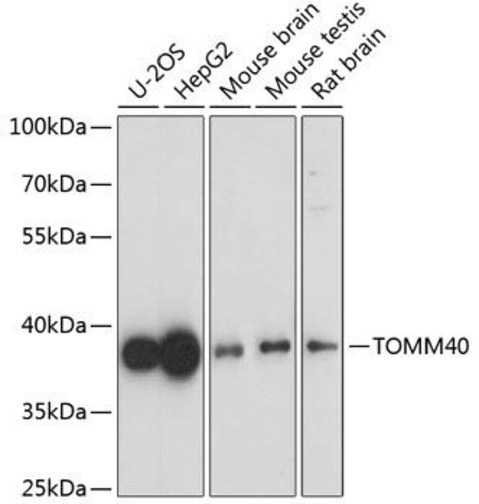 Anti-TOMM40 Antibody, 100 µl