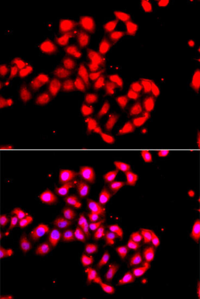 Anti-CAMK1D Antibody, 100 µl