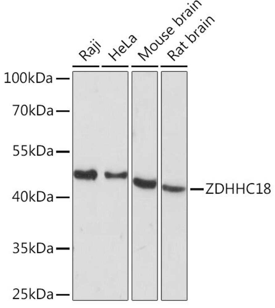 Anti-DHHC-18 Antibody
