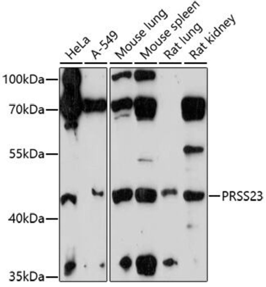 Anti-PRSS23 Antibody, 100 µl