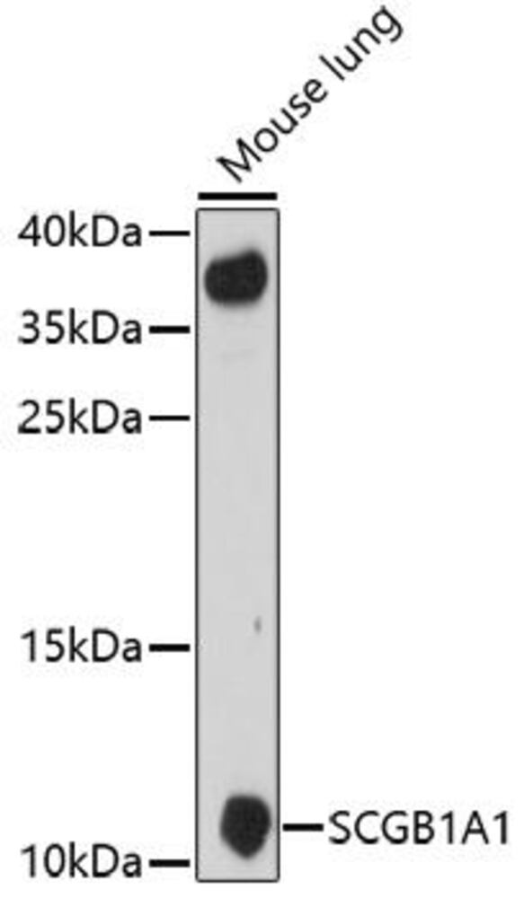 Anti-Uteroglobin Antibody, 100 µl