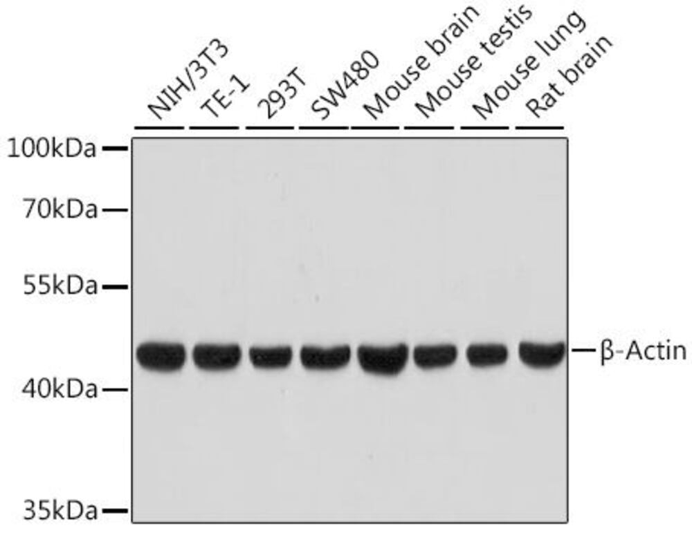 Anti-beta Actin Antibody [ARC5115-01]