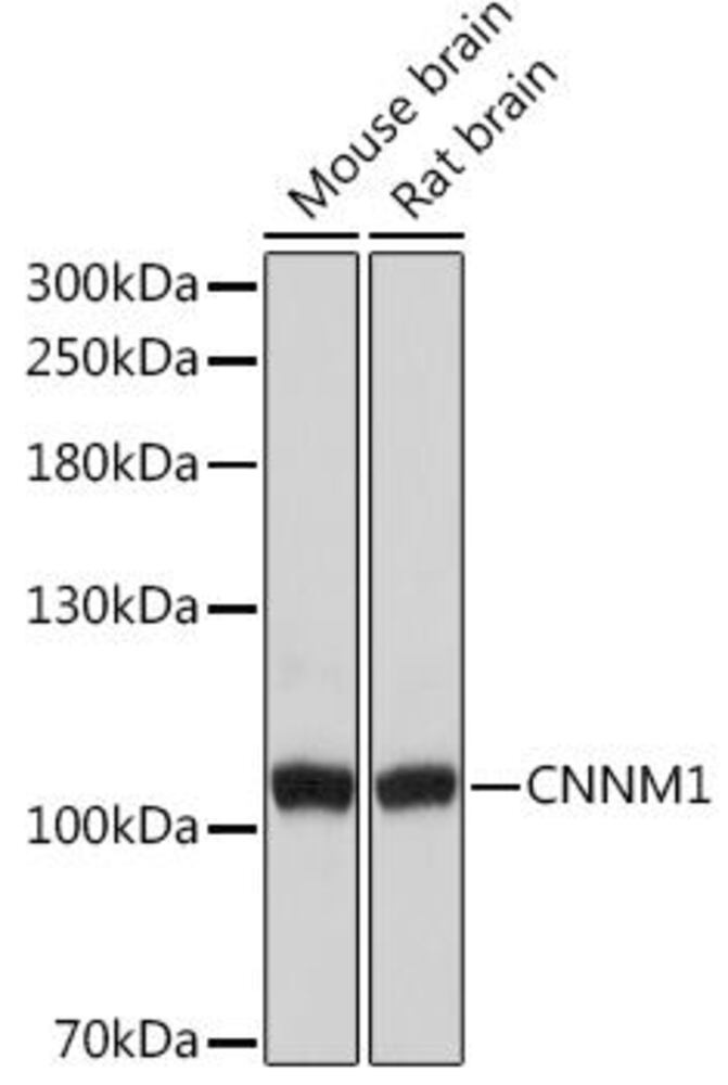 Anti-CNNM1 Antibody, 100 µl