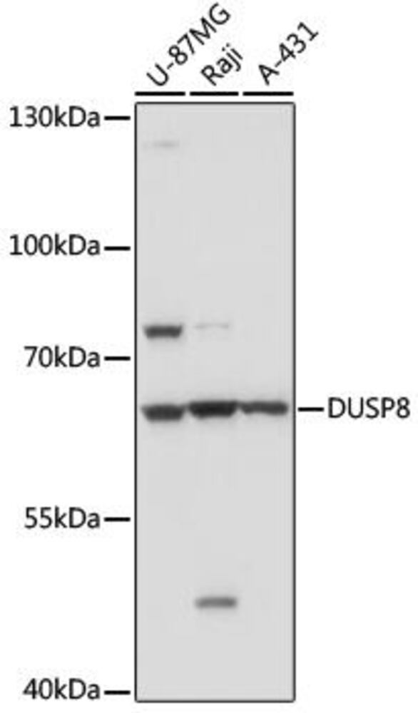 Anti-DUSP8 Antibody, 100 µl