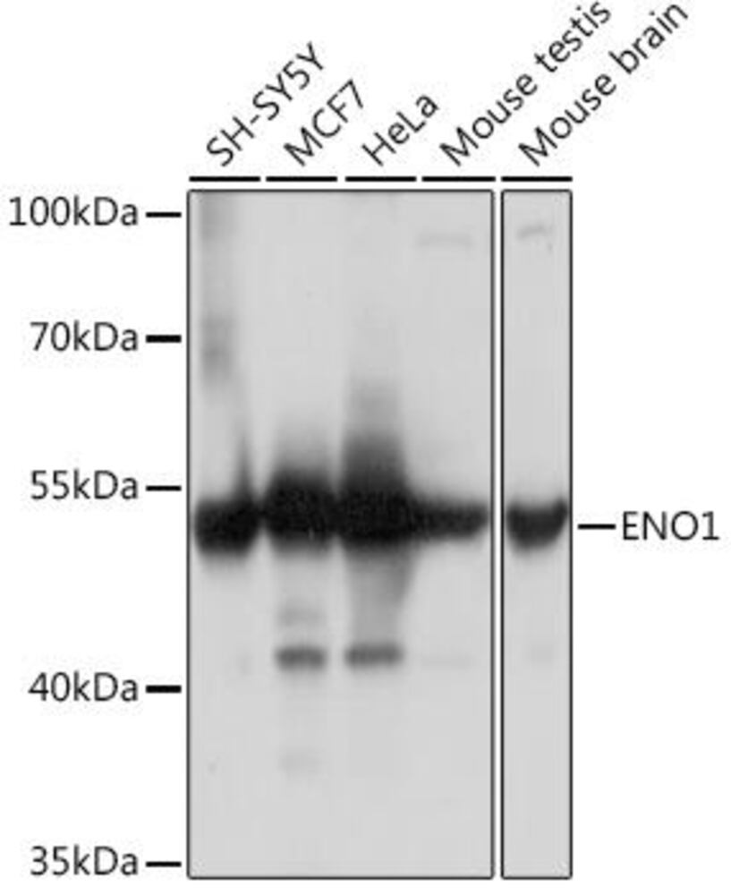 Anti-ENO1 Antibody, 100 µl