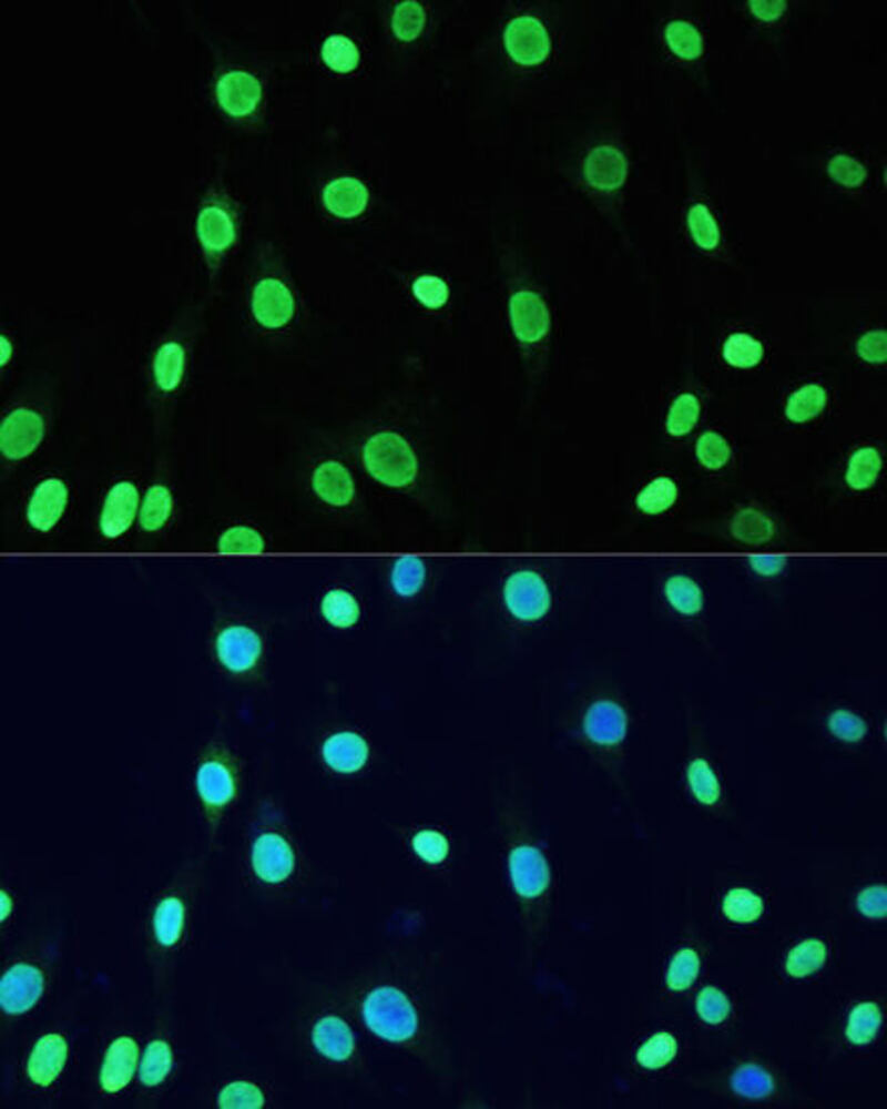 Anti-Dnmt1 (acetyl Lys1127 + Lys1129 + Lys1131 + Lys1133) Antibody, 100 µl