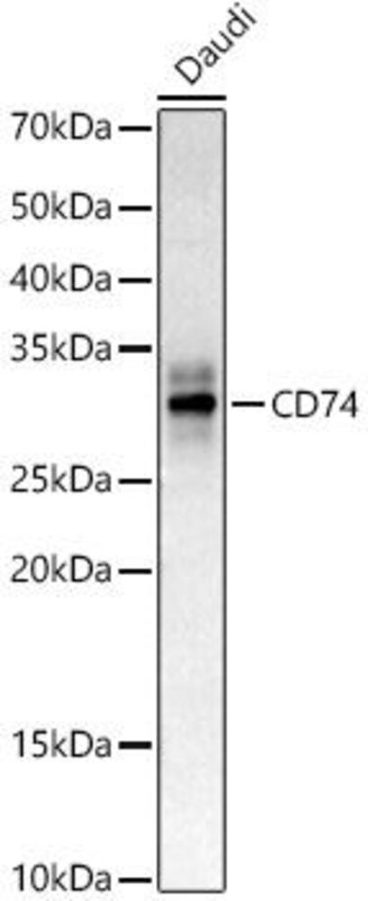 Anti-CD74 Antibody, 100 µl