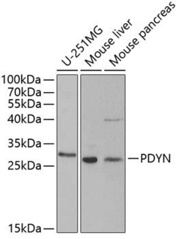 Anti-ProDynorphin Antibody, 100 µl