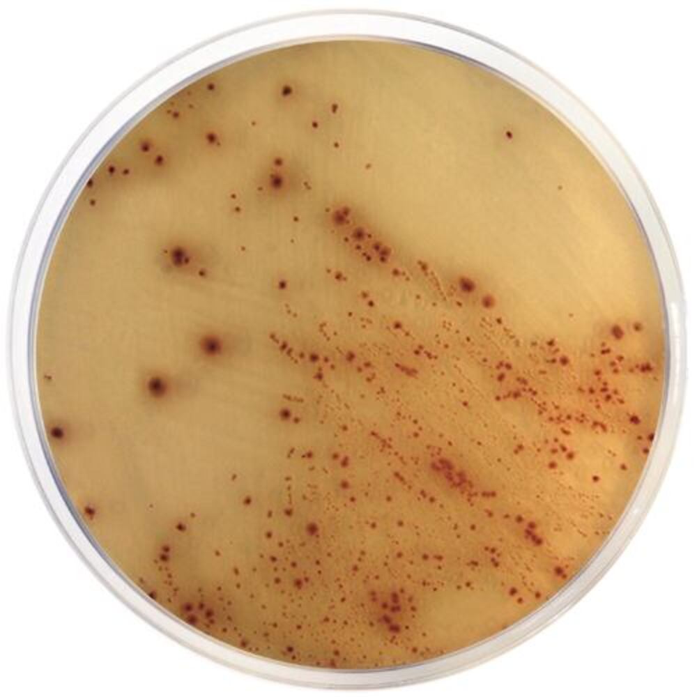 E. coli O157:H7 chromogenic agar (base)