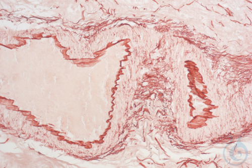 Image of Orcein kit 100 Tests BioGnost - Luminix Health