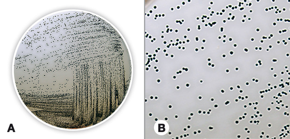 Baird Parker Agar (Base), ISO 11133, ISO 6888, ISO 22718, 500 g, plastic - Luminix Health