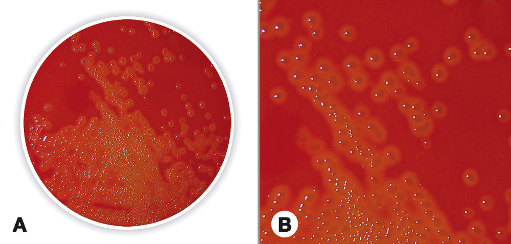 Blood Agar (Base), for microbiology, 500 g, plastic - Luminix Health