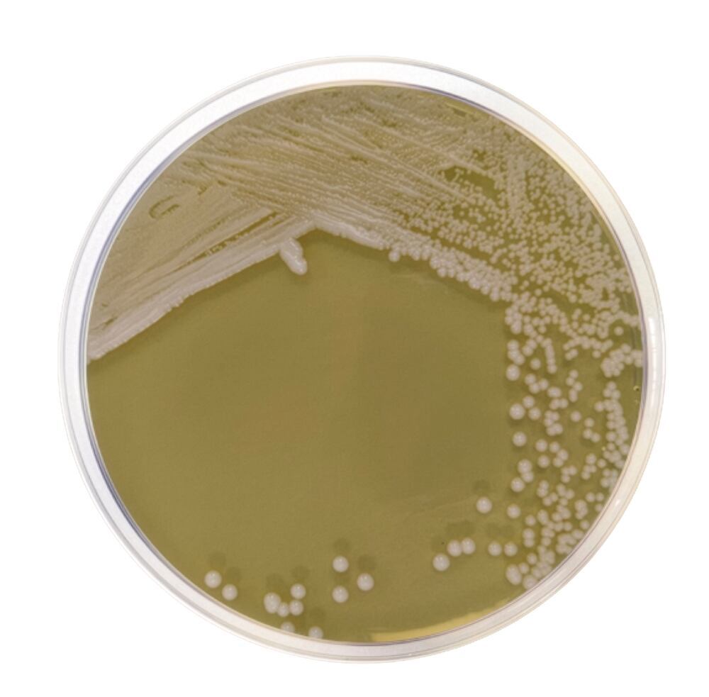 YPD Agar